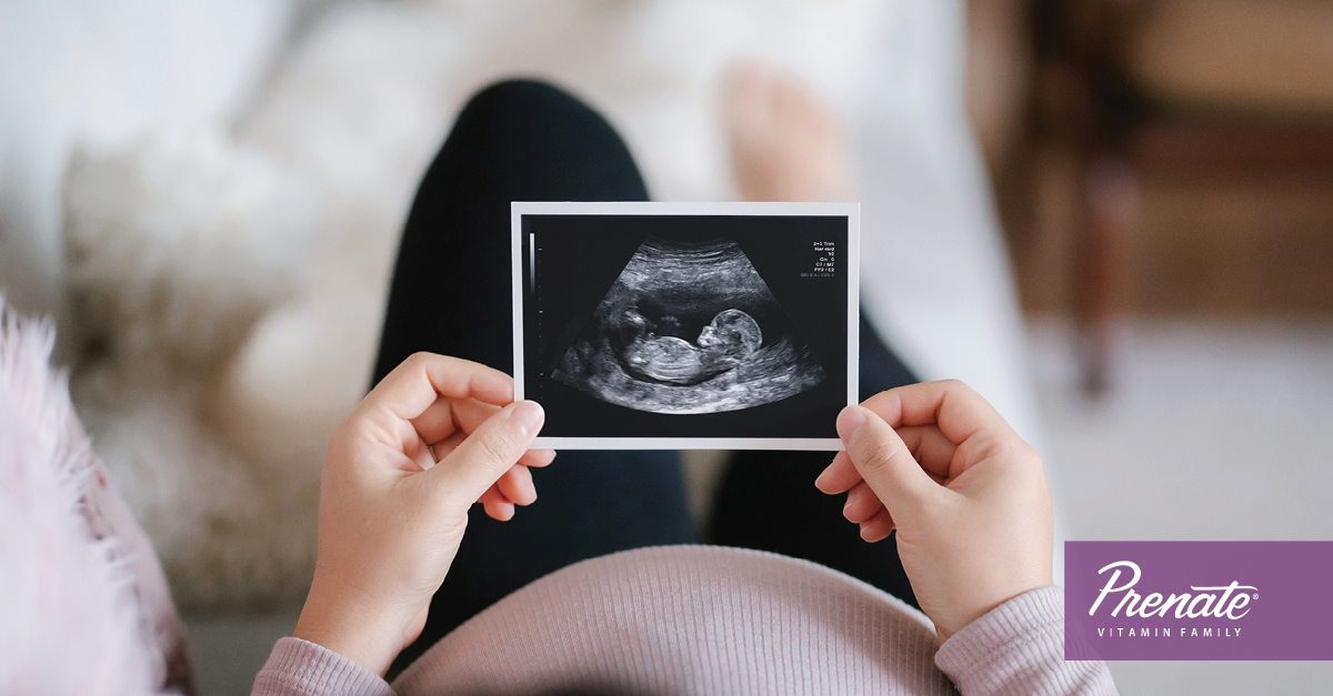 Woman holding ultrasound